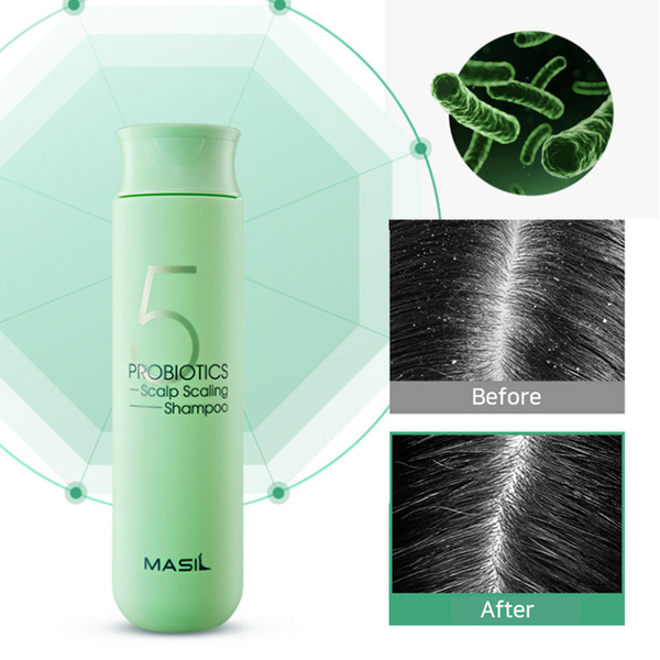 Шампунь для глубокого очищения кожи головы MASIL Probiotics Scalp Scaling Shampoo L2307 фото