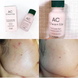 Сыворотка для точечного применения ETUDE HOUSE AC Clean Up Pink Powder Spot L0569 фото 4