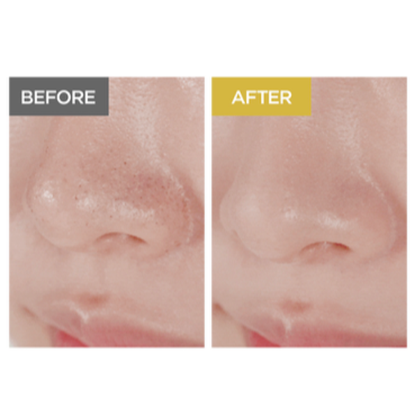 Очищувальна олія SKIN1004 Madagascar Centella Light Cleansing Oil L1165 фото