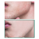 Крем для проблемной кожи SOME BY MI AHA/BHA/PHA 30 Days Miracle Cream L0295 фото 4